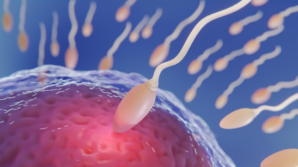 kriptozoospermi-siddetli-sperm-azligi